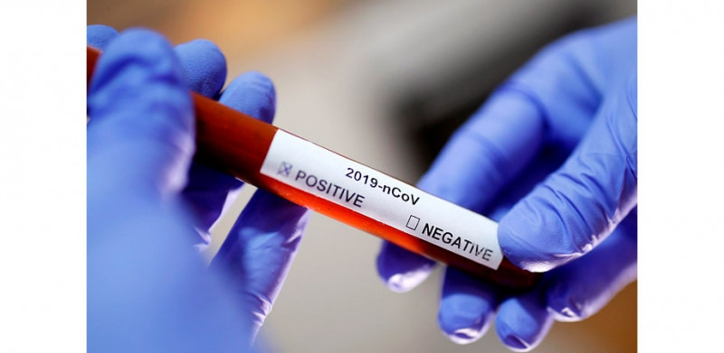 Мурашко: Россия готова экспортировать препараты для лечения COVID-19